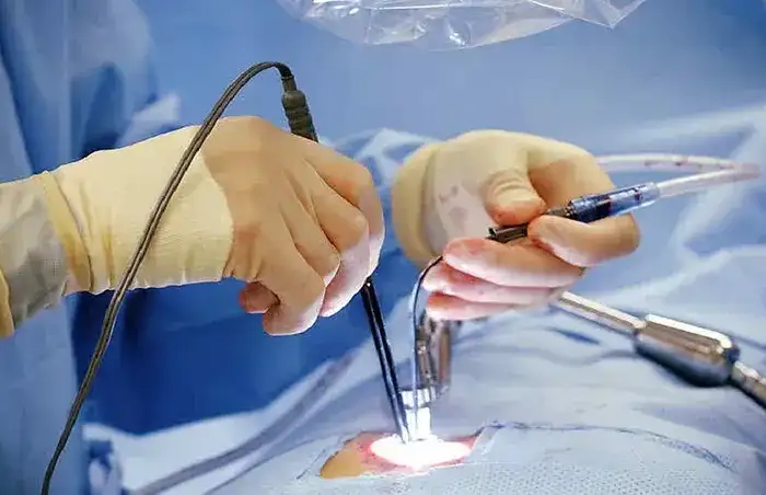 ENDOSCOPIC DISC SURGERY