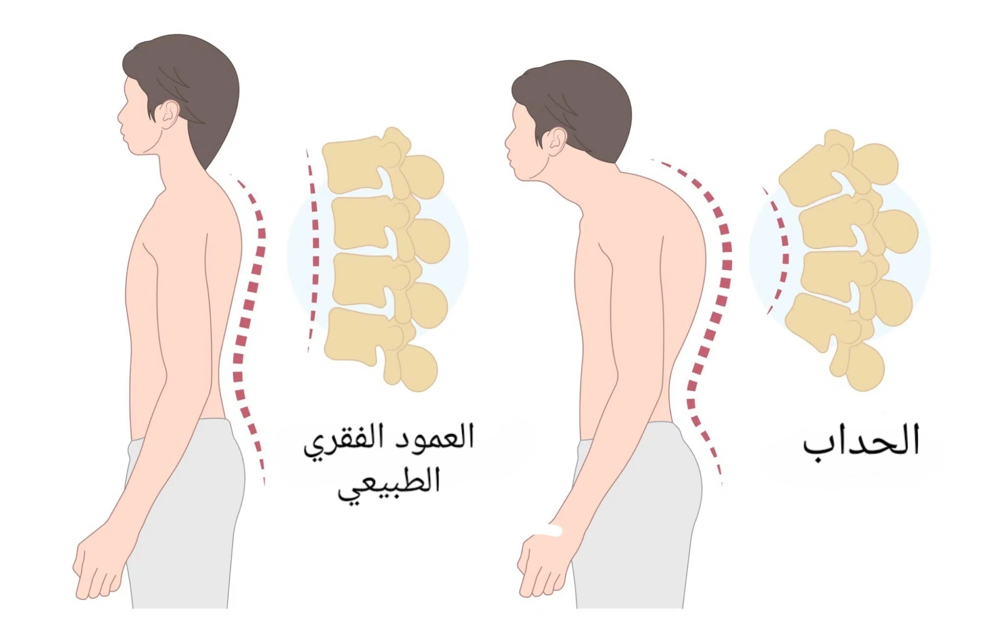 الحداب